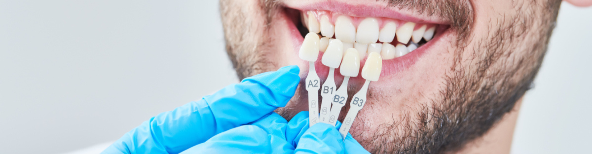 A man smiling while the dentist holds veneer samples in front of his teeth.